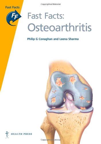 Book cover: Fast Facts Osteoarthritis And Gout (Fast Facts)